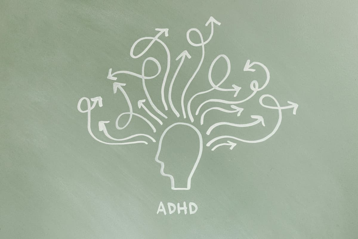 ADHD brain illustration showing neurodivergent thinking patterns - cognitive diversity in workplace offsites and retreats